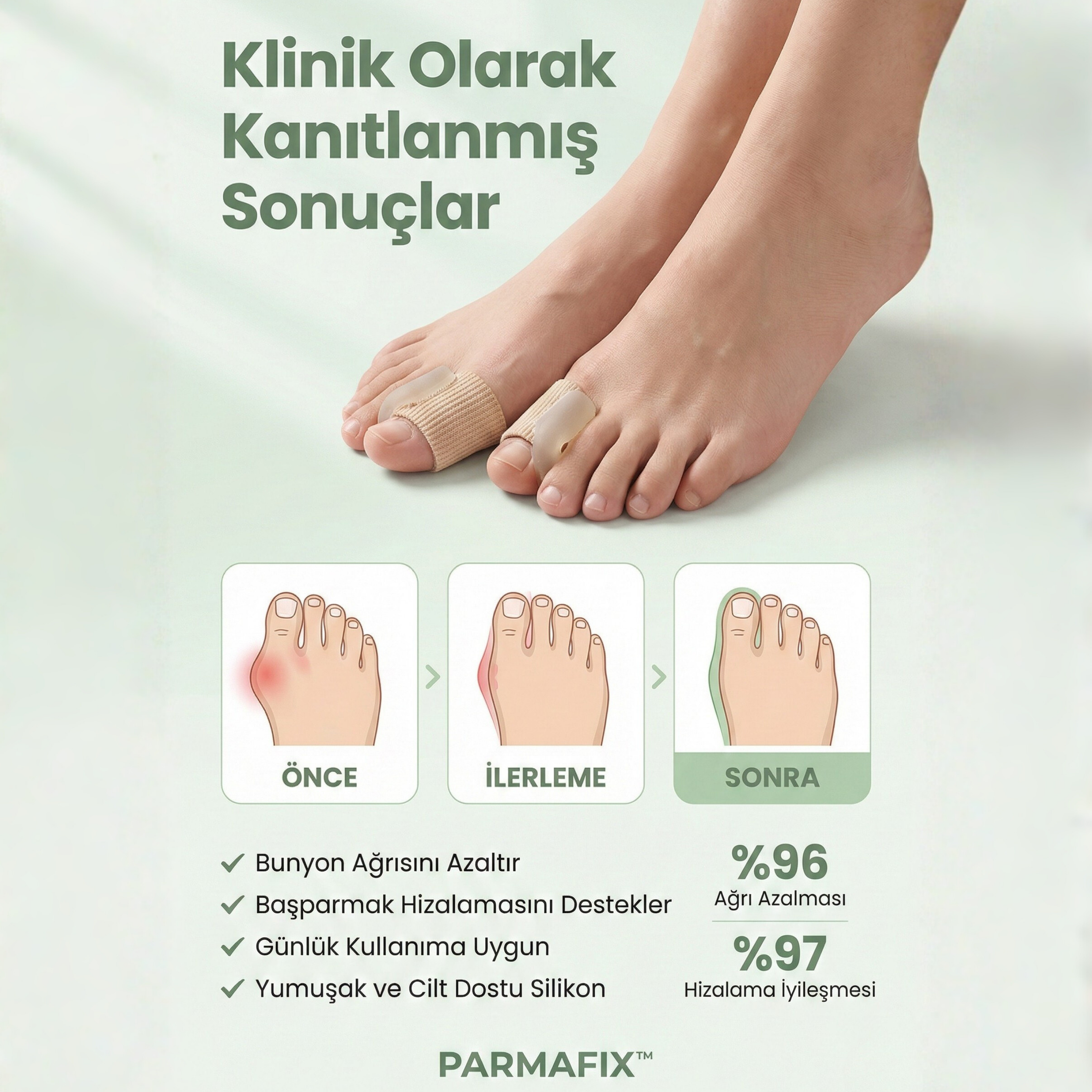 PARMAFIX™ Medikal Bunyon Düzeltici